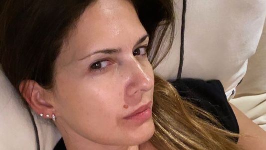 El accidente doméstico que sufrió Isabel Macedo