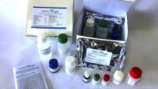 La ANMAT aprobó un nuevo test serológico de producción nacional: ¿Cómo son y cuándo podrán usarse?