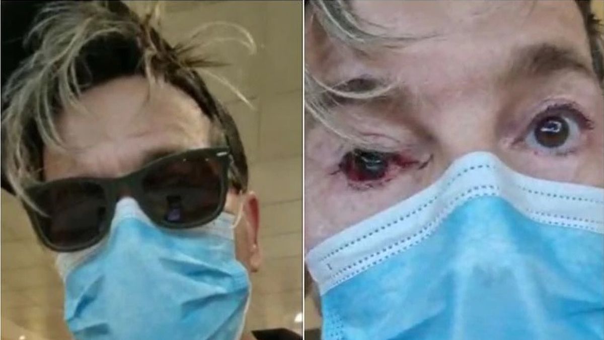 Tras luchar desde hace a&ntilde;os con sus problemas en la vista, Guido S&uuml;ller debi&oacute; ser operado de urgencia el fin de semana, ya que pod&iacute;a perder un ojo.&nbsp;