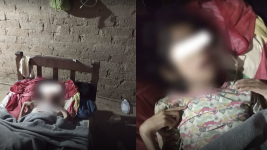 Quedó huérfana y ahora está sola: incluso los chanchos le comieron los dedos