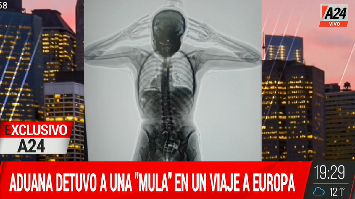 Una mula fue detenida en Ezeiza con 78 cápsulas destinadas a Barcelona. (Foto: captura A24).