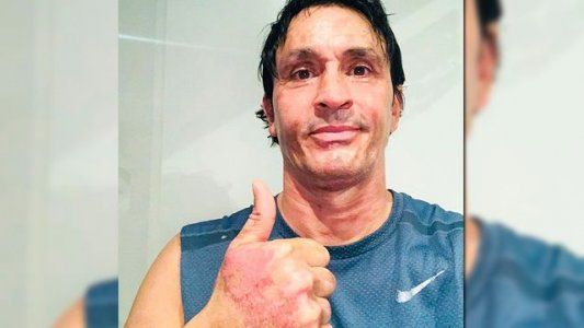 Sebastián Estevanez volvió a mostrarse tras el accidente doméstico y contó cómo se encuentra