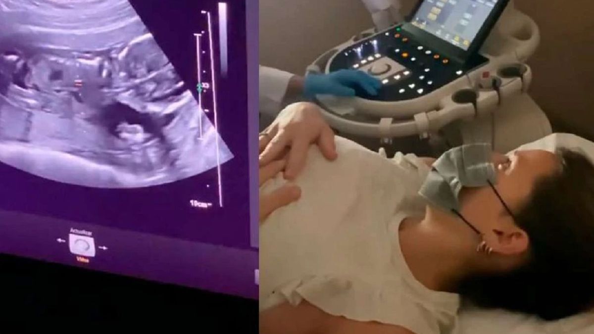 Mica Viciconte compartió el video de la ecografía de Luca, el bebé que espera con Fabián Cubero
