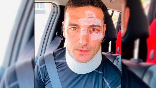 Lionel Scaloni fue atropellado en España: le hicieron estudios médicos y se retiró a su domicilio
