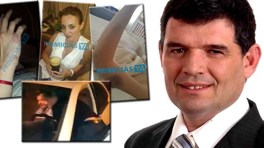 Así quedó la esposa del diputado Alfredo Olmedo después del escándalo en el hotel