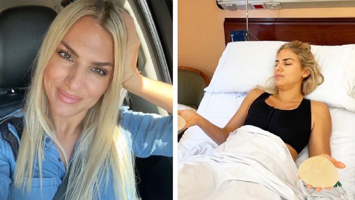 Carolina Oltra mostró el antes y el después de su operación de lolas