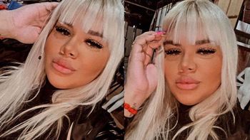 El preocupante mensaje de Morena Rial al mostrar su última ecografía: Causó dolor