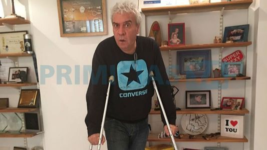 Coco Sily: Me caí de la moto y me fracturé el peroné