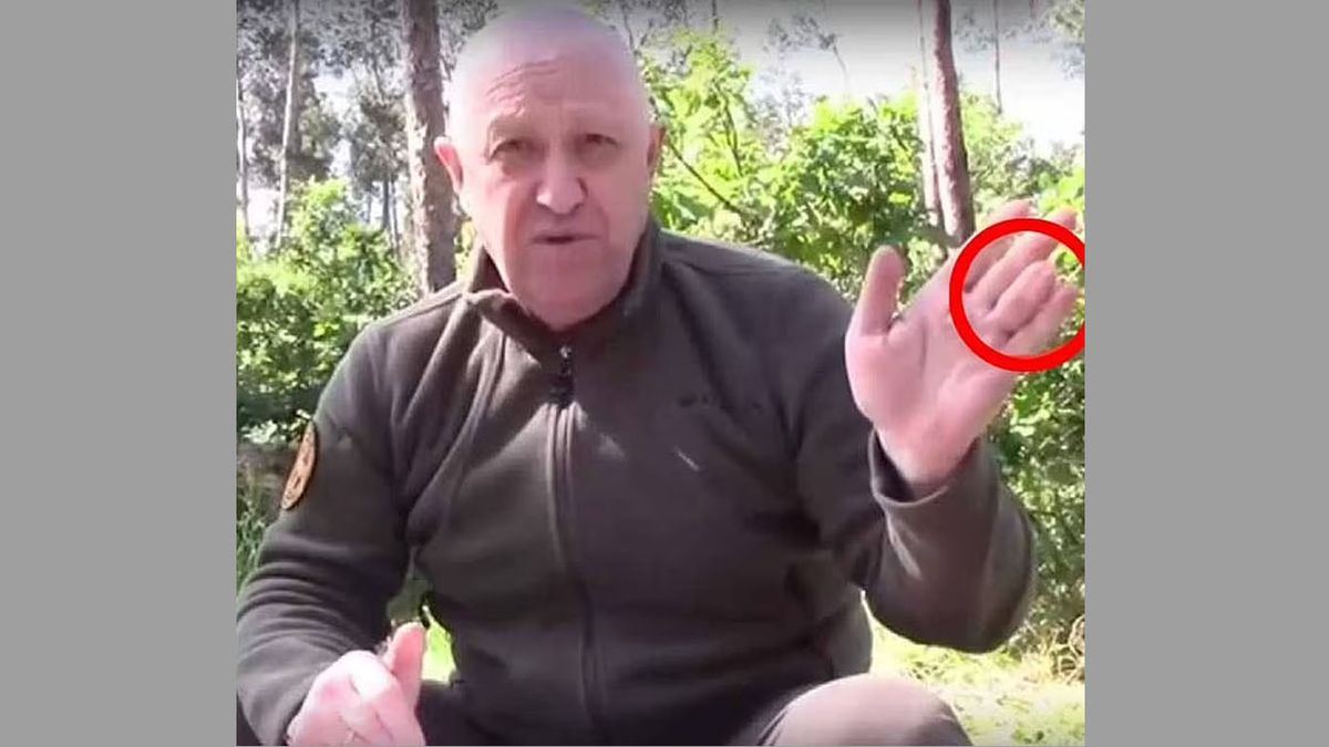 El cuerpo de Prigozhin, pese a estar calcinado fue reconocido por una mutilación que tenía en un dedo de su mano izquierda. (Foto: Gentileza Daily Mail)  