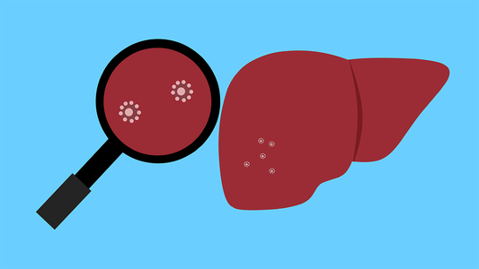 La Sociedad Argentina de Pediatría emitió un alerta sobre el brote de hepatitis de origen desconocido: ¿qué advirtieron?