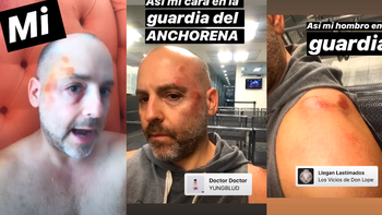 José María Muscari se accidentó en la Avenida Córdoba cuando conducía un monopatín eléctrico