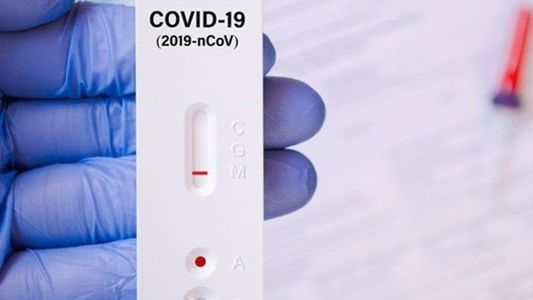 Coronavirus: los contagios siguen en descenso y se informaron un 21,8% menos que la semana pasada