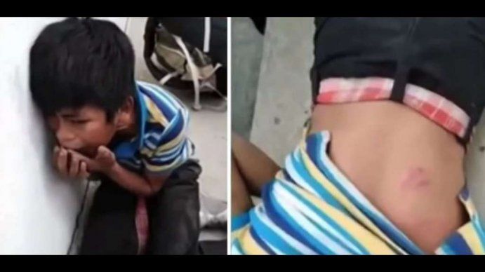Un niño quedó al borde de la muerte por la brutal paliza que recibió tras robar en un mercado
