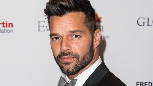 La polémica transformación de un ex Cuestión de Peso: quiere parecerse a Ricky Martin