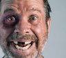 ¿Tu sueño fue que se te caen los dientes?: el verdadero significado psicológico y emocional