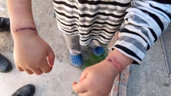 Rescataron a un nene que había sido atado con alambres por su madre en Moreno