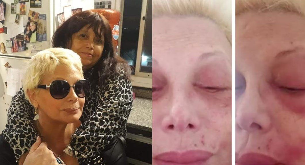 Marcela la “brujita de Quilmes” que le curó a Carmen Barbieri de la culebrilla: “Ahora le quedó una parálisis facial”
