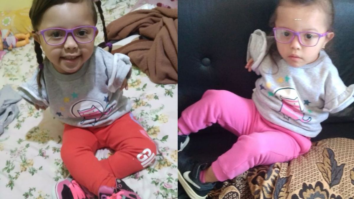 Tiene 3 años y necesita dos prótesis para poder caminar: la conmovedora historia de Liz  (Foto: gentileza familia Fariña)