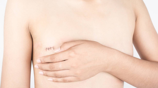 Día internacional de la lucha contra el Cáncer de Mama: se realizará un evento de concientización