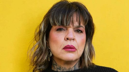La foto del impactante retoque estético de Sandra Priore, ex Gran Hermano: mirá cómo quedó