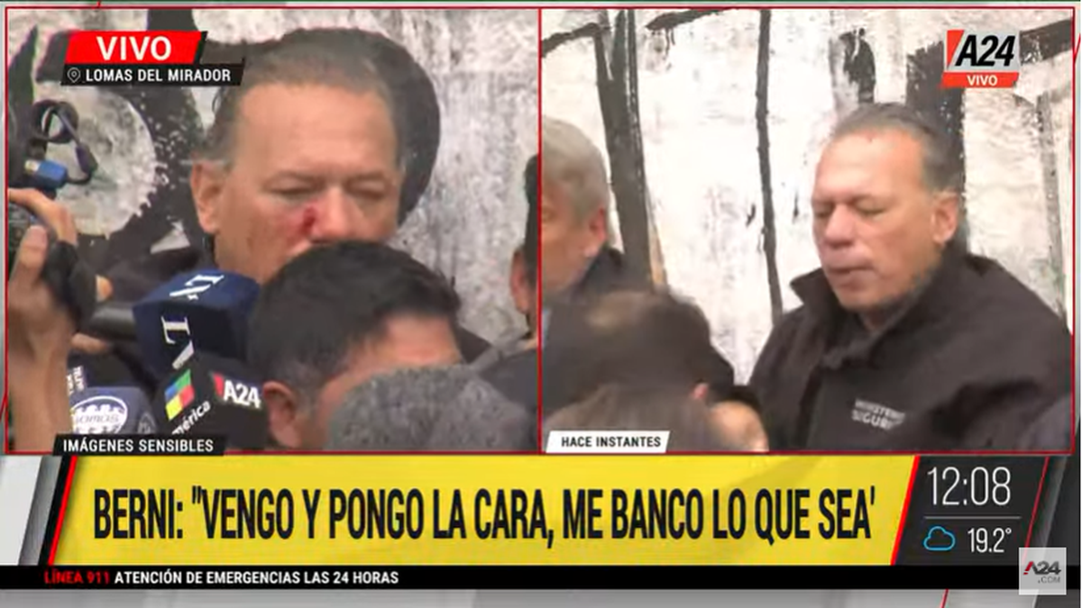 &nbsp;Sergio Berni habló tras la violenta agresión a manos de colectiveros (Foto: Captura A24).
