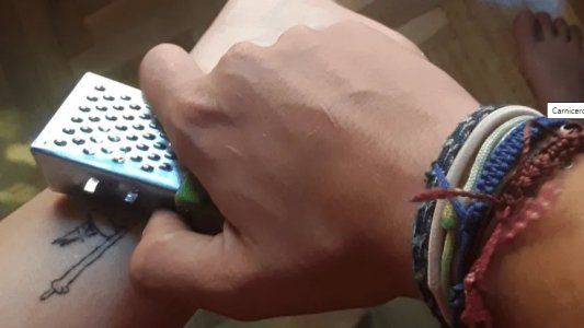 Se hizo un tatuaje, no le gustó cómo le quedó y se lo sacó con un rallador