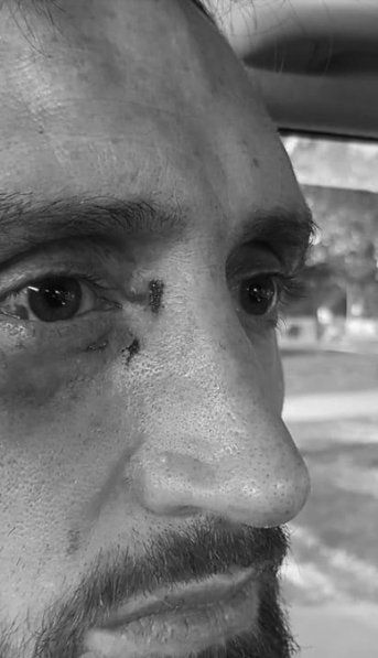 Hinchas de Peñarol de Mar del Plata atacaron a Alejandro Reinick, basquetbolista de Quilmes
