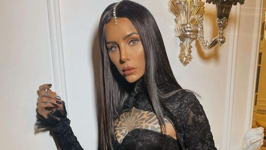 Cande Tinelli contó cuántas cirugías estéticas se hizo