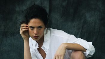 Delfina Chaves reveló el accidente que sufrió de chica ante los comentarios de una cirugía estética