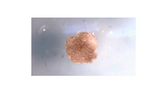 En Estados Unidos crearon los biobots, un híbrido entre ser vivo y robot y que abre la puerta a múltiples interrogantes