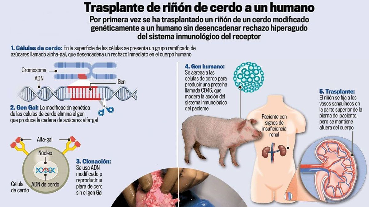 C&oacute;mo se realiza la modificaci&oacute;n gen&eacute;tica de un ri&ntilde;&oacute;n de cerdo para ser trasplantado al ser humano (Foto: Instagram).