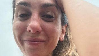 Cinthia Fernández sufrió un doloroso accidente en sus vacaciones: el video