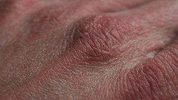 Los errores que resecan la piel con el frío y cómo evitarlo