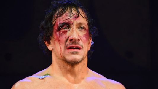 El problema de salud que obligó a Nico Vázquez suspender las funciones de Rocky: Dolor insoportable