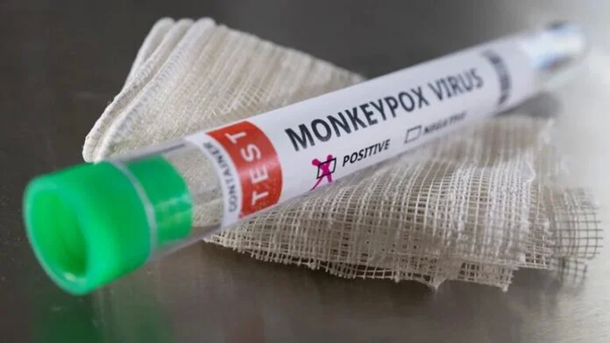 Estados Unidos planea distribuir vacunas de la viruela del mono a los contactos cercanos de personas infectadas.&nbsp;