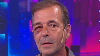 Fabián Rubino tuvo que ser operado de urgencia tras perseguir a un nene que le robó su celular