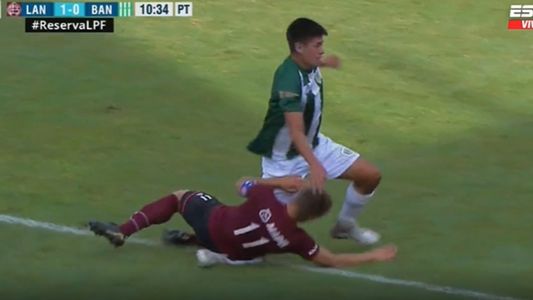 La jugada más insólita de los últimos tiempos: le dieron un pelotazo en la cara, lesionó gravemente a un rival y lo expulsaron