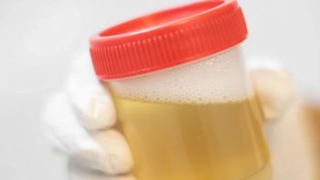 Orina espumosa: cuándo puede ser una señal de daño renal