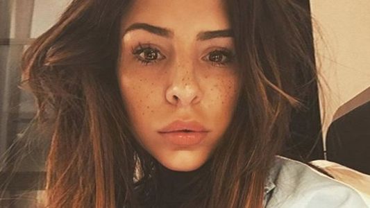La dura confesión de Cande Tinelli sobre un problema del pasado