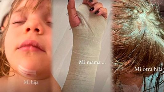 Wanda Nara publicó fotos de las heridas que sufrió su familia