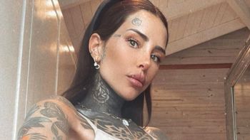 Cande Tinelli sufrió un doloroso accidente en su casa y mostró la impactante herida