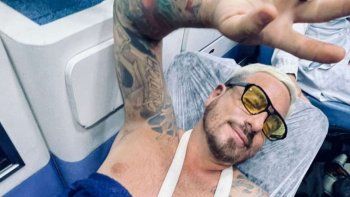 Las fotos de cómo quedó el brazo de Fede Bal tras el terrible accidente que sufrió en Brasil