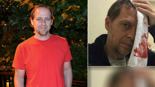 Matías Martin con la cabeza ensangrentada después de un accidente doméstico