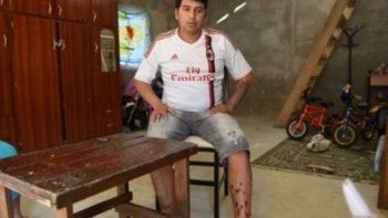 Acribillan a balazos a Ema Pimpi Sandoval, condenado por el atentado a la casa de Bonfatti