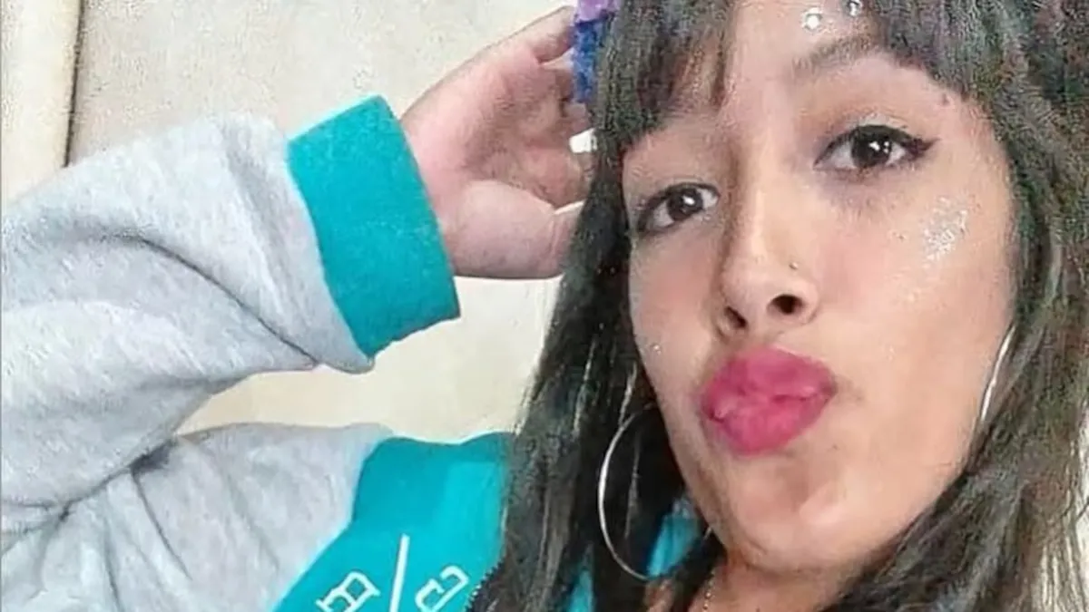 Agustina Soledad Rodr&iacute;guez, de 25 a&ntilde;os, sufri&oacute; graves quemaduras en el rostro, el cuello y el pecho tras el ataque. (Foto: redes sociales).