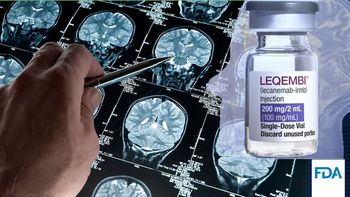 La FDA de Estados Unidos aprobó un medicamento que retrasa los efectos del Alzheimer. (Foto: A24.com) La FDA de Estados Unidos aprobó un medicamento que retrasa los efectos del Alzheimer. (Foto: A24.com)
