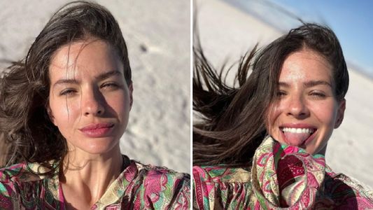 La China Suárez se lastimó en Jujuy y mostró las heridas de guerra