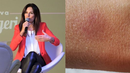 Frigerio, asaltada y golpeada por motochorros: Ya naturalizamos y parece normal que nos peguen y roben