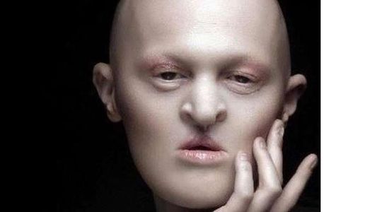 Una enfermedad rara hace triunfar a una modelo