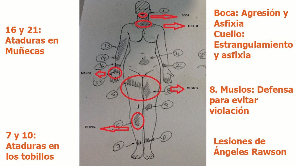 Las lesiones en el cuerpo de Ángeles Rawson que demostraban su muerte por estrangulamiento y asfixia y el abuso sexual. Estaban en la autopsia, pero tuvieron que ser 